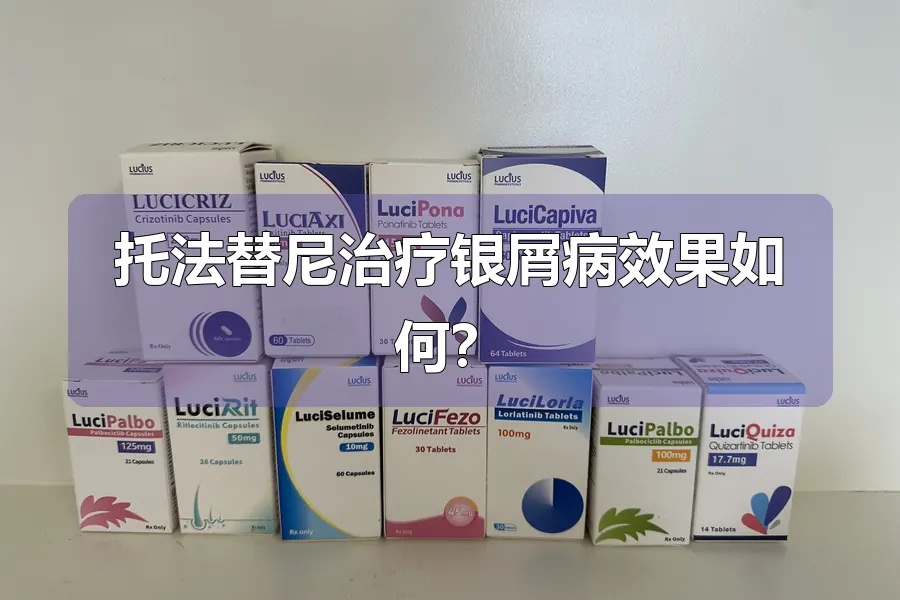 托法替尼治疗银屑病效果如何？